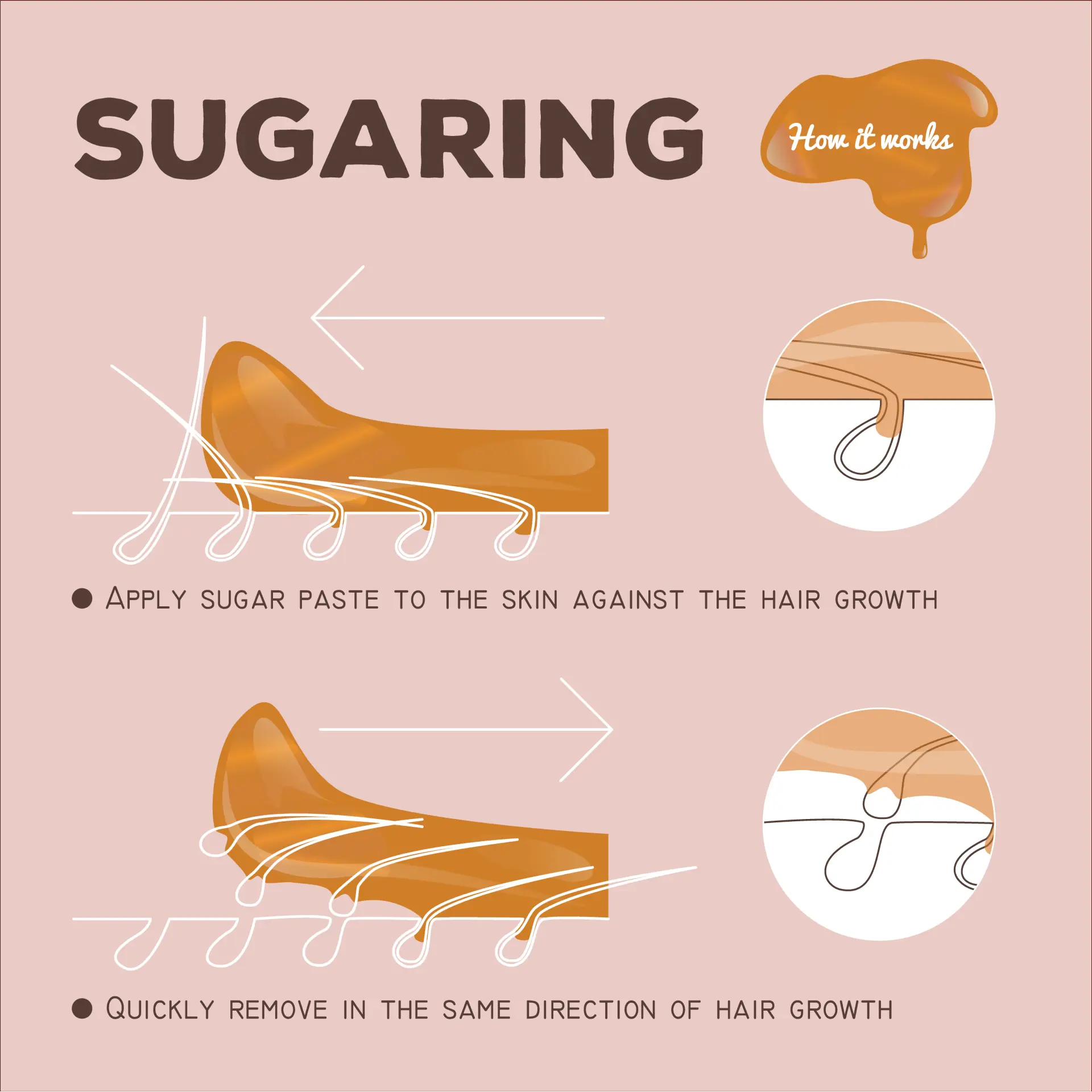 How body sugaring works: sugar paste is applied against the direction of hair growth, then removed in the direction of growth